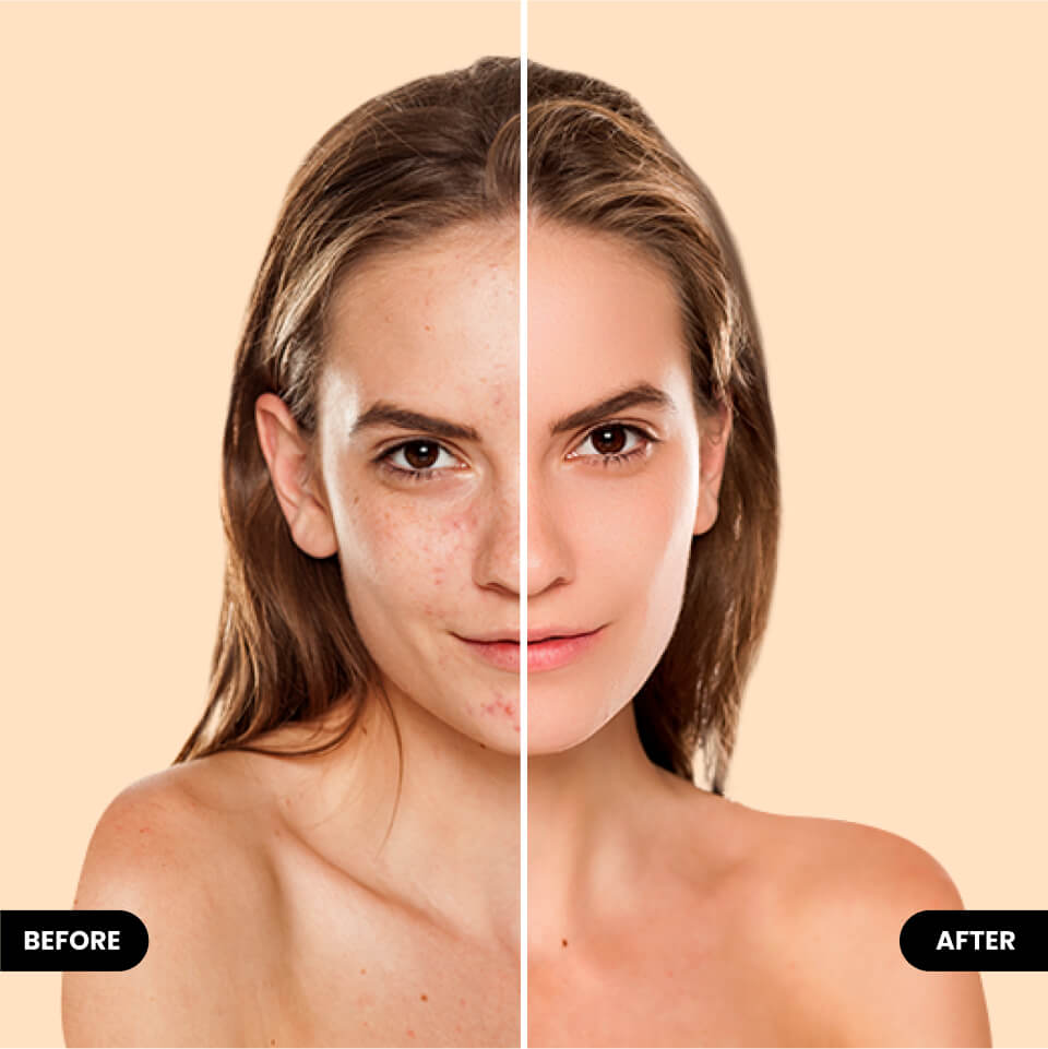 use retouch tool to get flawless skin with BeautyPlus