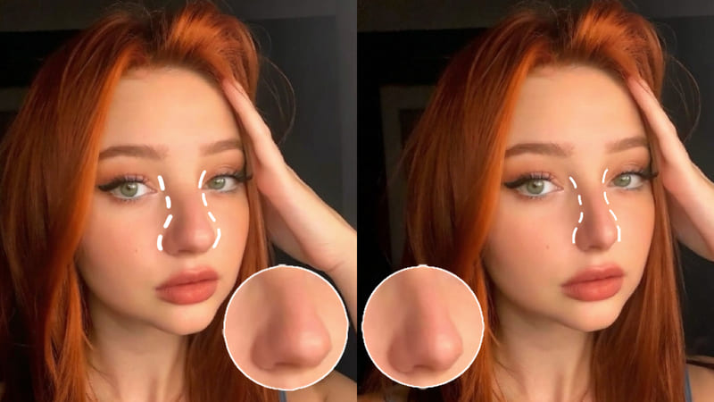 Best Virtual Nose Job Filter For An Ideal Profile